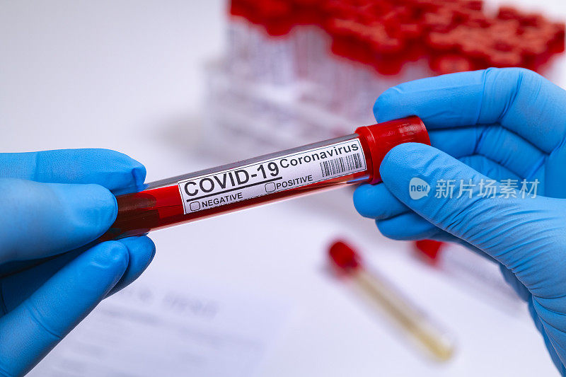 冠状病毒COVID - 19检测新型冠状病毒